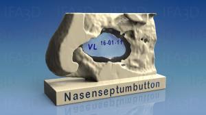 nasal septum button